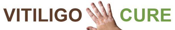 Vitiligo Cure Website